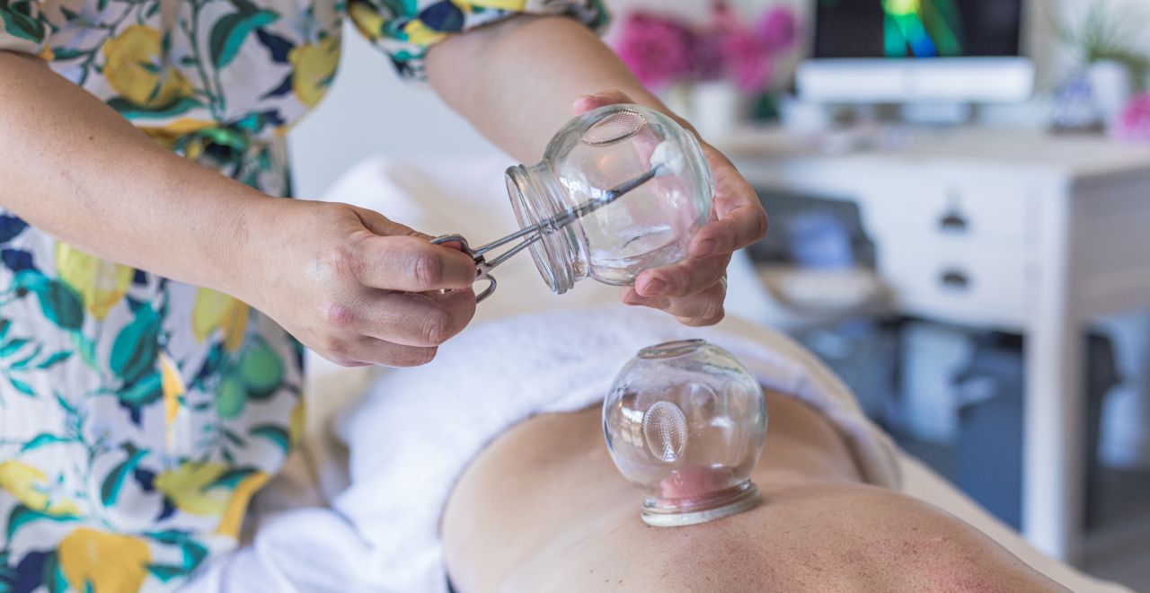 Cupping Therapy