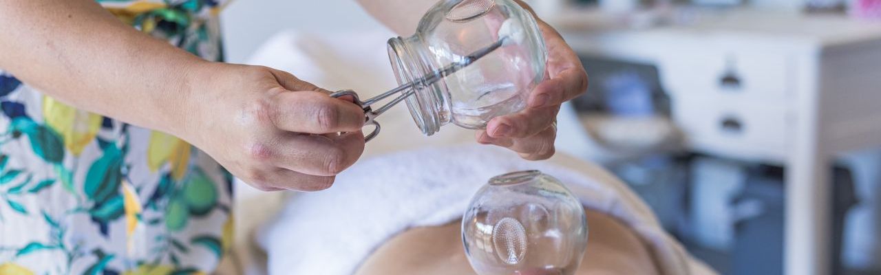 Cupping Therapy